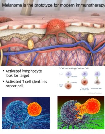 Emerging Cancer Screening & Treatment Methods Including COVID19 Implications